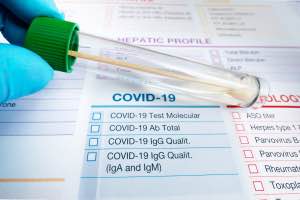 Using Antibody Solutions for Medical Checks. Ascot