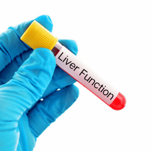 Liver Test near me at clinic - Product ID: 108002 Ascot A-Liver Test near me at clinic - Product ID: 108002 Ascot