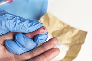 Test HPV and Herpes cell cbc full blood count exam Ascot