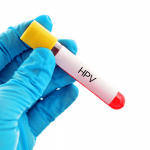 HPV Variant type test Men & women testing Ascot