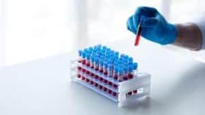 mineral profile blood test, complete count, CBC Ascot