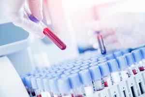 Immuno Blood Levels: What is It about? Ascot