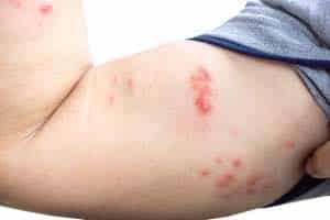 Guidelines And Who Should Get Checked? Ascot