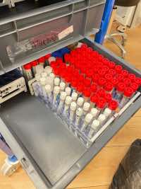 5 Million – On the rise: a vaccine is being studied Ascot