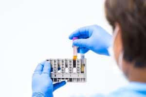 cbc, fbc, complete blood count, full blood count test Ascot