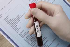 anaemia blood test, low Ferritin, iron deficiency