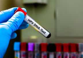 Drugs for viral infections that cure 100% of all Ascot