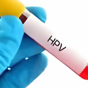 HPV Test. Variant type Men & women testing home Ascot