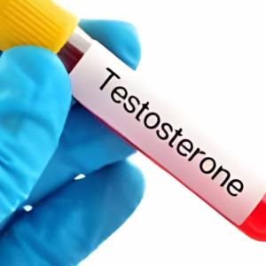 Testosterone Blood Test elite london escorts 24/7 vip ascot