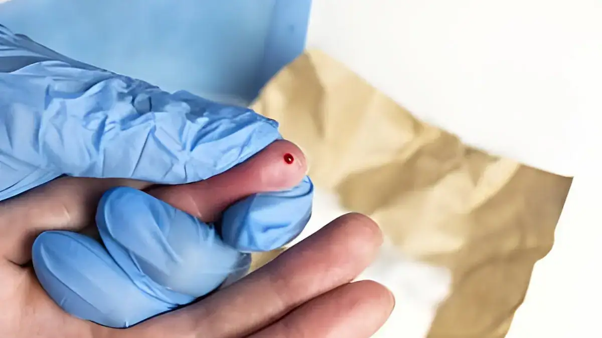 Haemophilia? Know the symptoms elite escorts do!